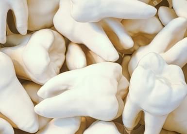 Everything A Stoner Needs To Know About Wisdom Teeth Removal & Smoking