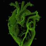 Green Heart Thumbnail Image